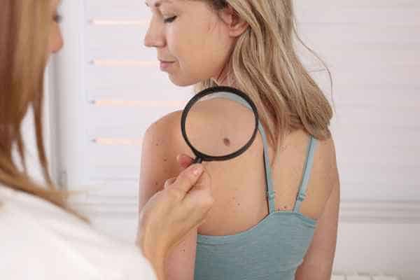 What Are Traditional Skin Lesion Removal Methods Harwich?