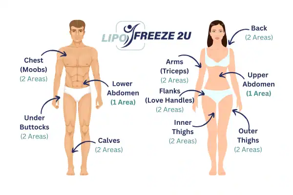 Areas you can have fat freezing treatment Harwich
