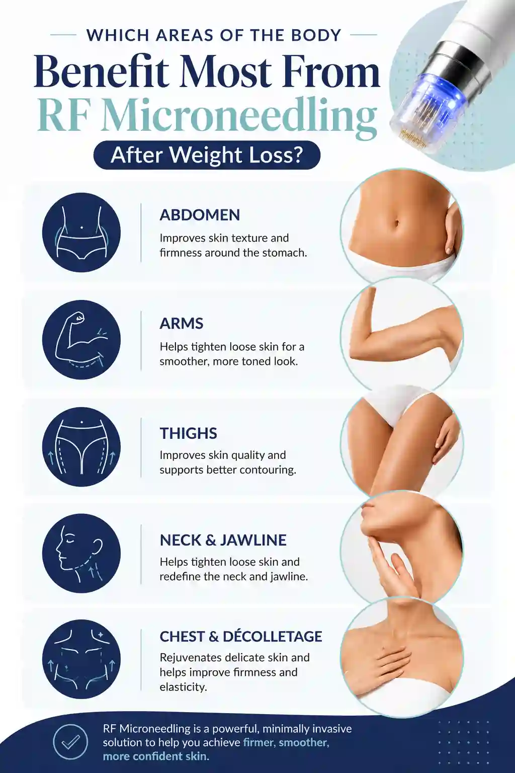 Which Areas of the Body Benefit Most From RF Microneedling After Weight Loss Harwich